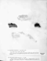 Polyporus igniarius image